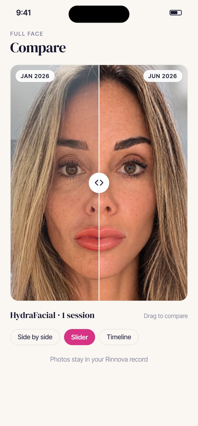 Two photos of the same face lined up, with a slider dividing before and after