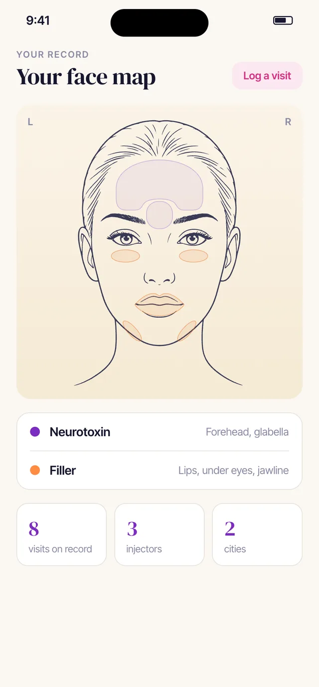 The Rinnova face map: the areas treated with Botox and filler shaded on a face diagram, with a legend by product.